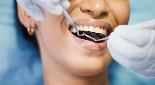 Best Teeth Whitening  in Kenton, OH