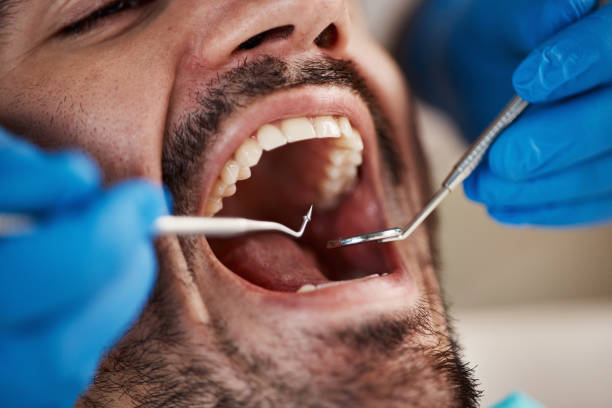 Best Knocked-Out Tooth Emergency  in Kenton, OH